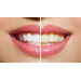 Відбілюючі смужки для зубів Crest 3D White Glamorous White